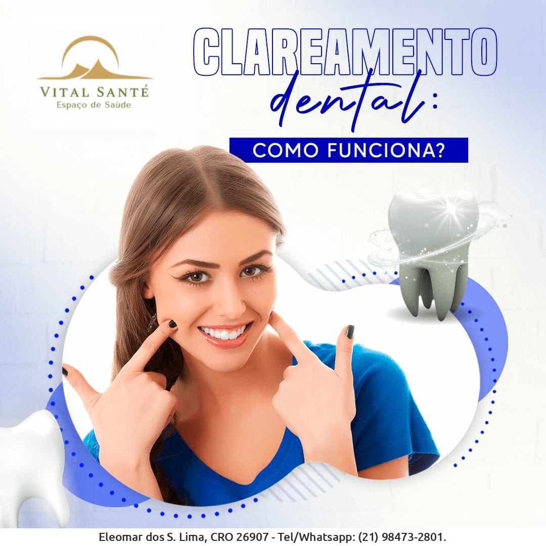 dentista - recreio dos bandeirantes clareamento estética